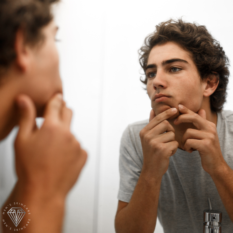 Náo esprema suas espinhas, cuide delas com o skincare kit Téchne